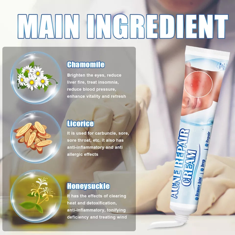 Acne Repair Cream | Herbal Ointment for Pimples, Acne Marks, Postules, and Blackheads - Image 10