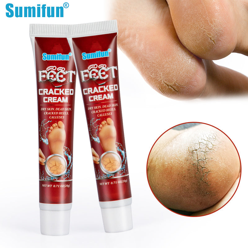Cracked Hands and Feet Cream | Skin Ointment for Cracked Heels, Dry Skin and Dead Skin - Image 9