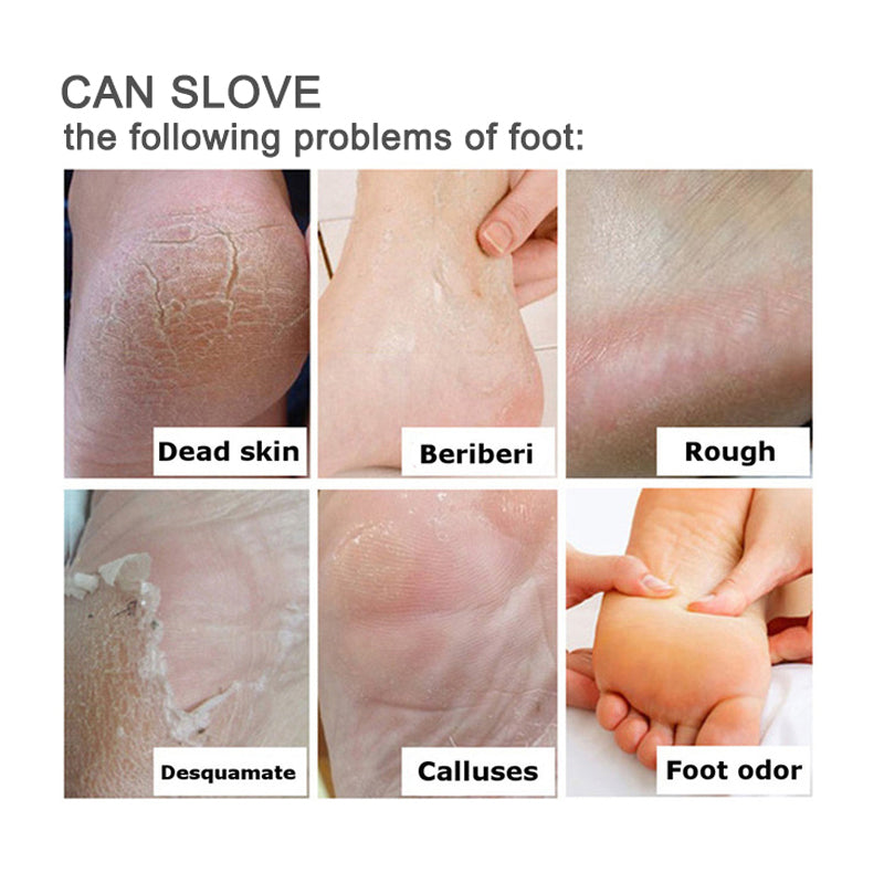 Foot Care Cream | Herbal Cream for Athlete's Foot, Itchy Feet and Foot Infections - Image 14