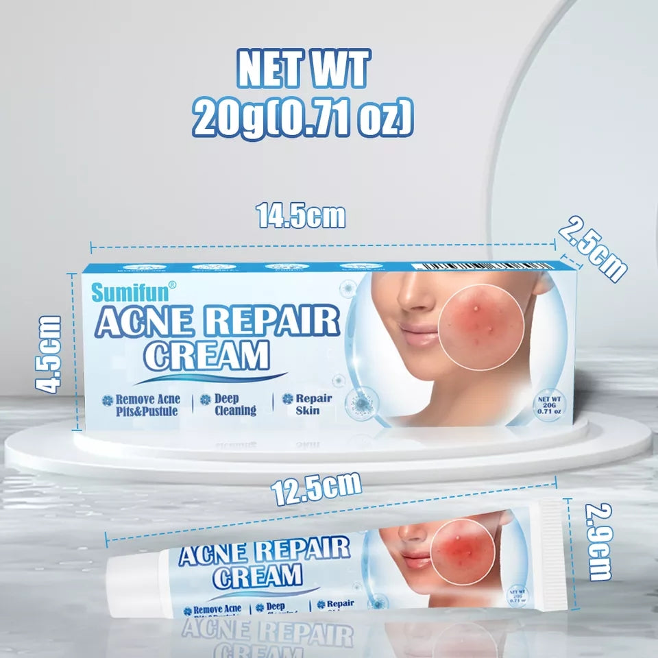 Acne Repair Cream | Herbal Ointment for Pimples, Acne Marks, Postules, and Blackheads - Image 11