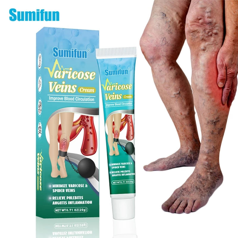 Varicose Veins Cream | Topical Cream for Varicose Veins and Spider Veins