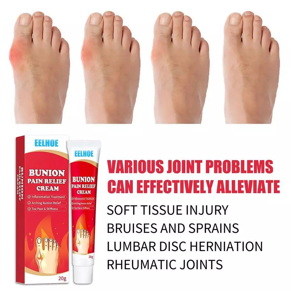 Bunion Pain Relief Cream | Herbal Cream for Bunions and Stiff Toes - Image 8