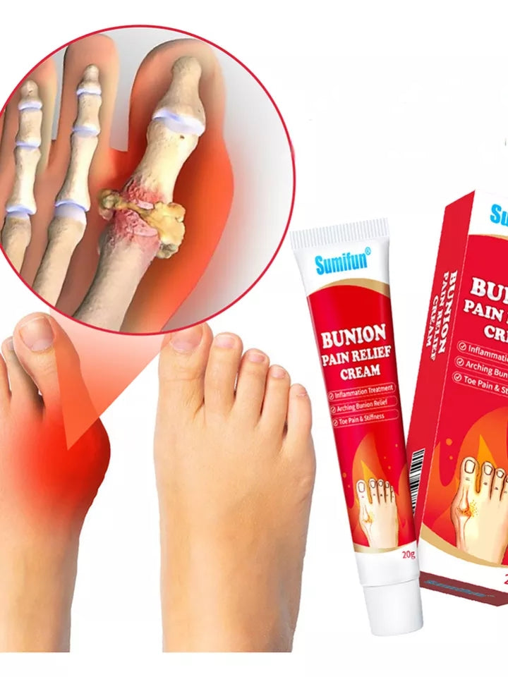 Bunion Pain Relief Cream | Herbal Cream for Bunions and Stiff Toes - Image 6