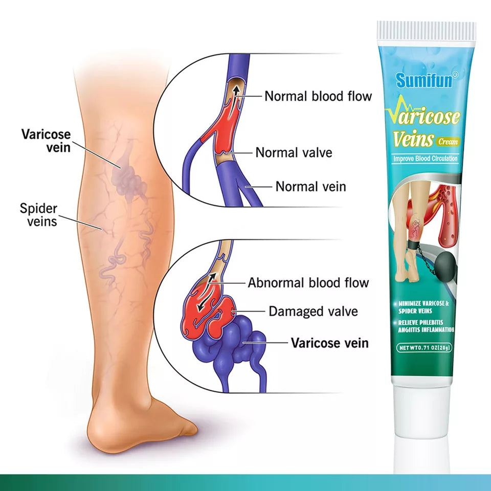 Varicose Veins Cream | Topical Cream for Varicose Veins and Spider Veins - Image 5