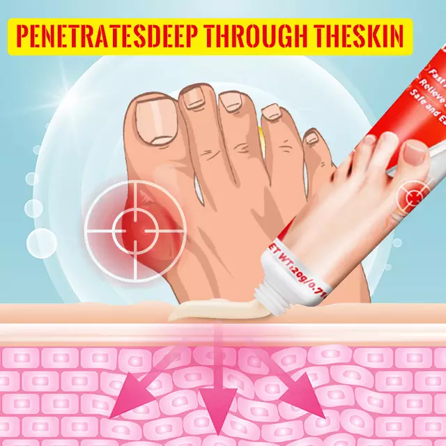 Upgraded Buinon Balm | Pain Relief Cream for Bunion and Stiff Toes - Image 5