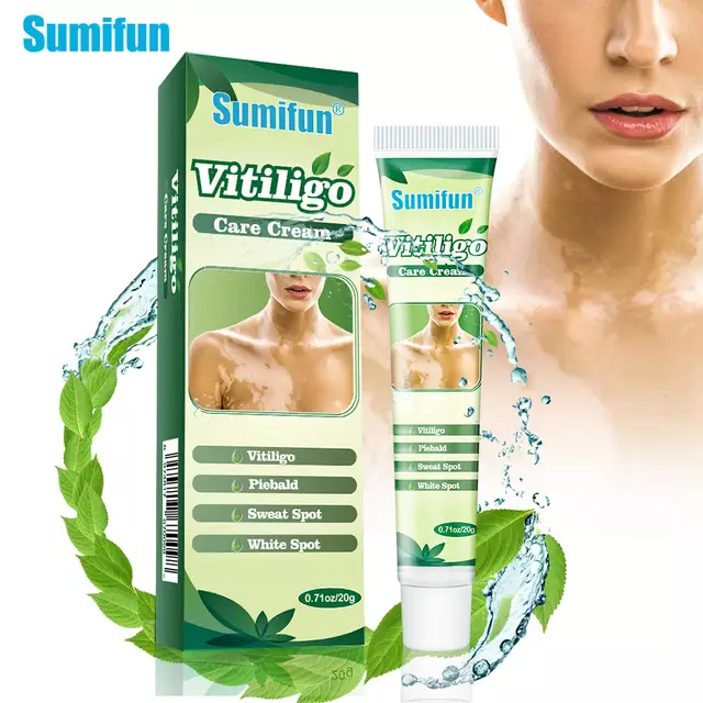 Vitiligo Care Cream | Topical Ointment for White Spots, Piebald, and Vitiligo - Image 4