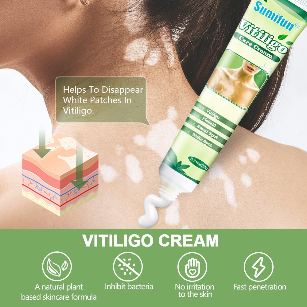 Vitiligo Care Cream | Topical Ointment for White Spots, Piebald, and Vitiligo - Image 2