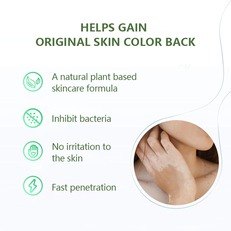 Vitiligo Care Cream | Topical Ointment for White Spots, Piebald, and Vitiligo - Image 12