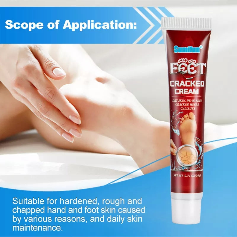 Cracked Hands and Feet Cream | Skin Ointment for Cracked Heels, Dry Skin and Dead Skin - Image 7
