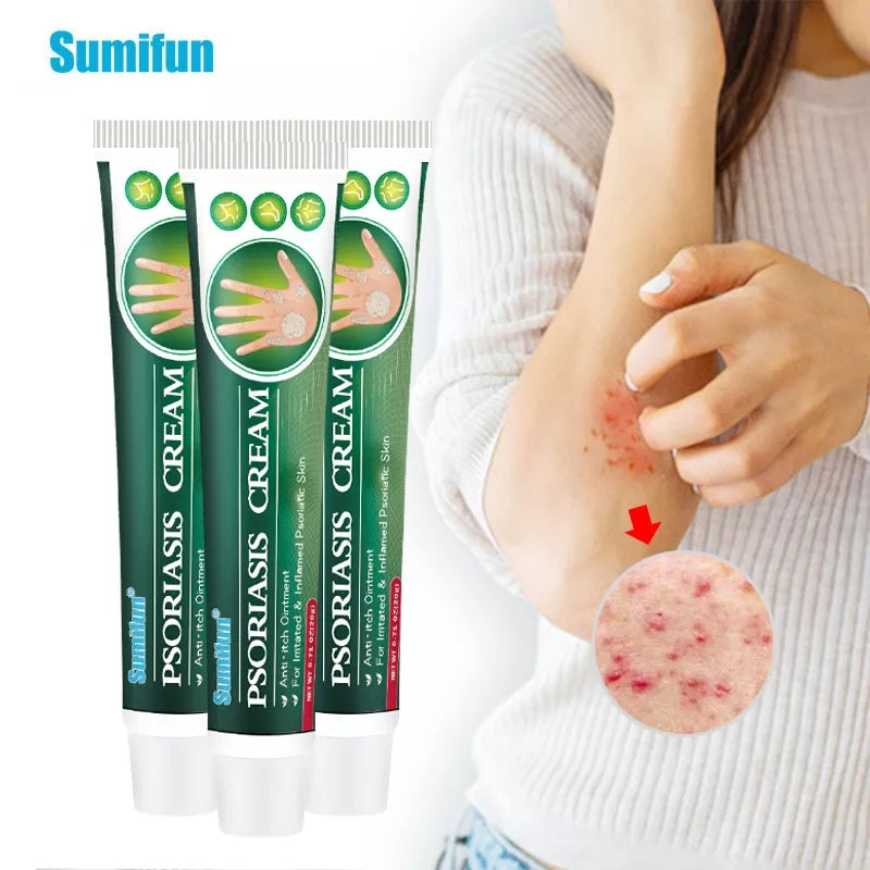 Psoriasis Cream | Herbal Cream for Psoriasis, Dermatitis, Eczema, and Itching - Image 13