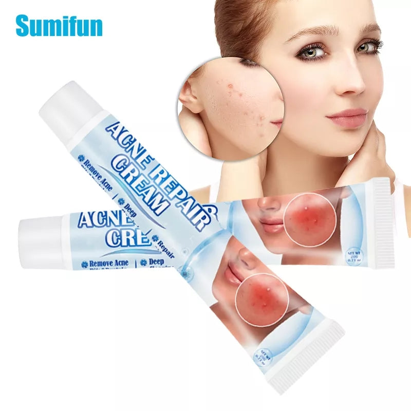 Acne Repair Cream | Herbal Ointment for Pimples, Acne Marks, Postules, and Blackheads - Image 9