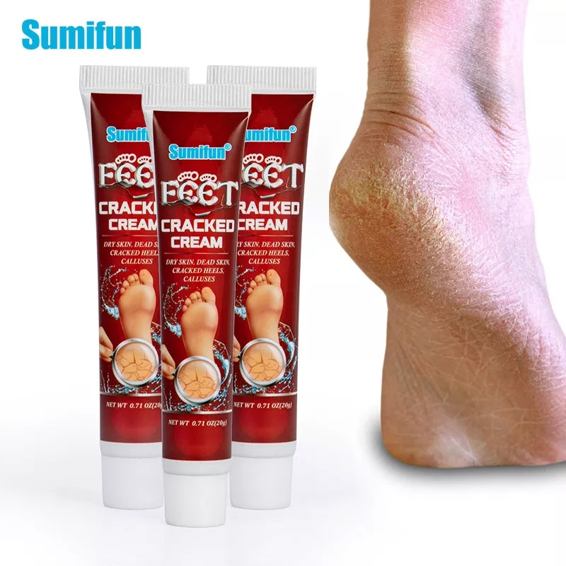 Cracked Hands and Feet Cream | Skin Ointment for Cracked Heels, Dry Skin and Dead Skin - Image 6