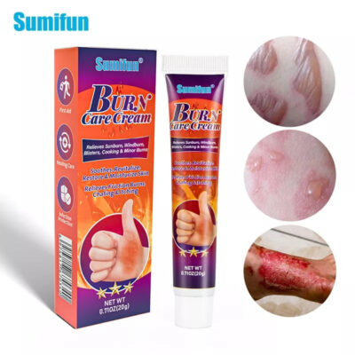 Burn Care Cream | Herbal Cream for Burns, Scalds and Blisters