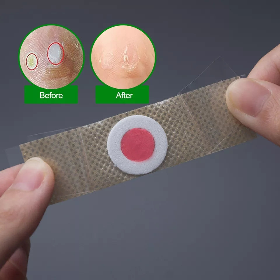 Foot Corn Removal Plaster (42 Plasters) | Medicated Patch for Foot Corns, Calluses, and Foot Warts - Image 3