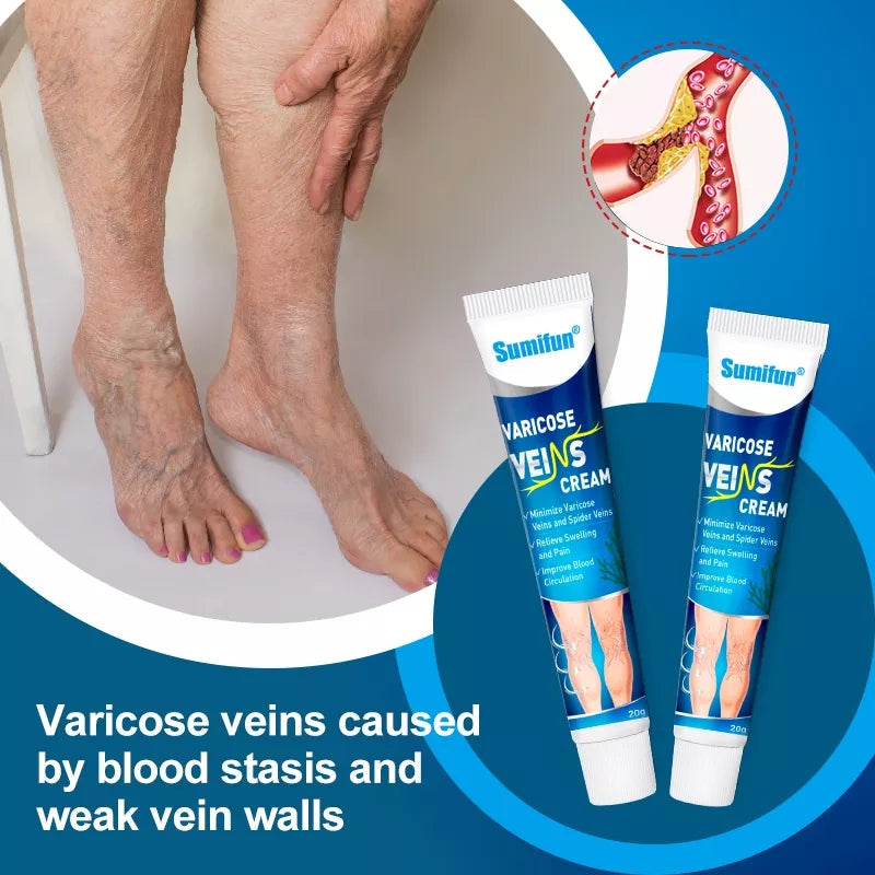 Varicose Veins Cream | Herbal Cream for Spider Veins and Varicose Veins - Image 2