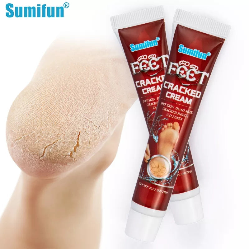 Cracked Hands and Feet Cream | Skin Ointment for Cracked Heels, Dry Skin and Dead Skin - Image 8