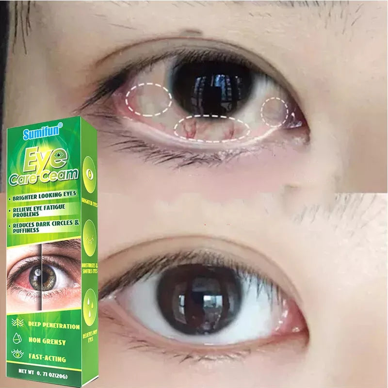 Eye Care Cream | Herbal Cream for Bright Eyes, Eye Fatigue, Dark Circles, and Puffiness - Image 13