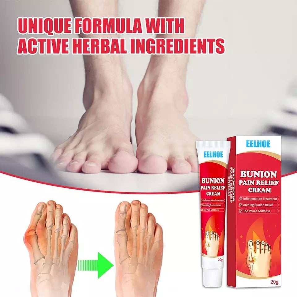 Bunion Pain Relief Cream | Herbal Cream for Bunions and Stiff Toes - Image 5
