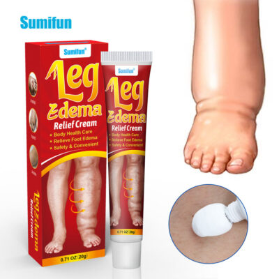 Leg Edema Relief Cream | Topical Cream for Foot Edema