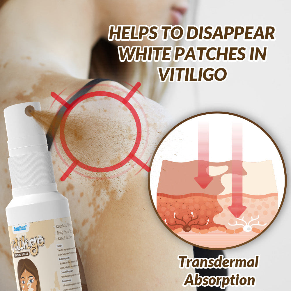Vitiligo Removal Spray | Topical Spray for Skin Pigmentation and White Patches - Image 4