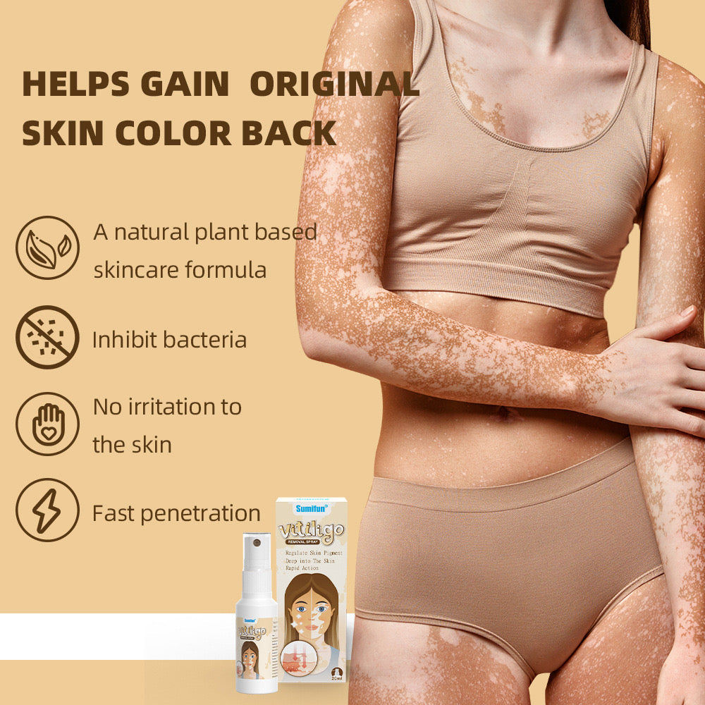 Vitiligo Removal Spray | Topical Spray for Skin Pigmentation and White Patches - Image 3