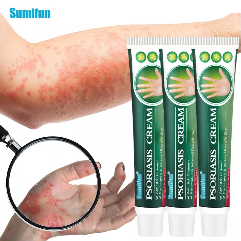 Psoriasis Cream | Herbal Cream for Psoriasis, Dermatitis, Eczema, and Itching - Image 6