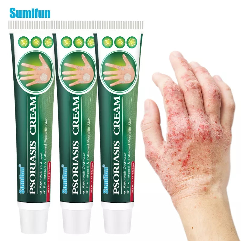 Psoriasis Cream | Herbal Cream for Psoriasis, Dermatitis, Eczema, and Itching - Image 7