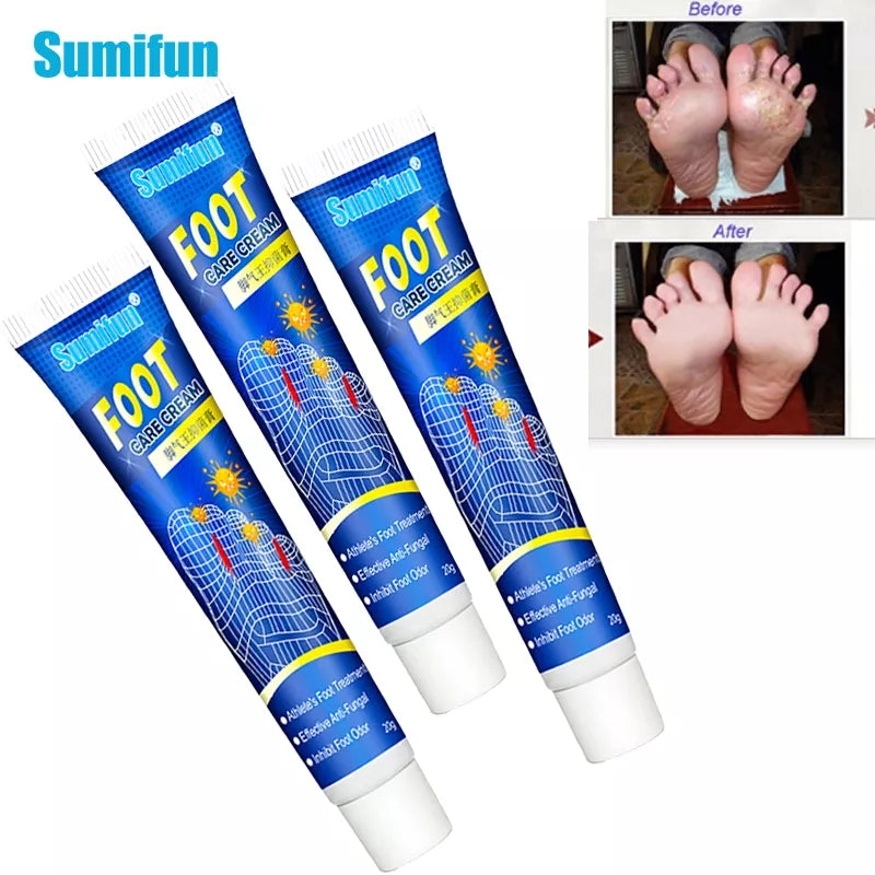 Foot Care Cream | Herbal Cream for Athlete's Foot, Itchy Feet and Foot Infections - Image 10