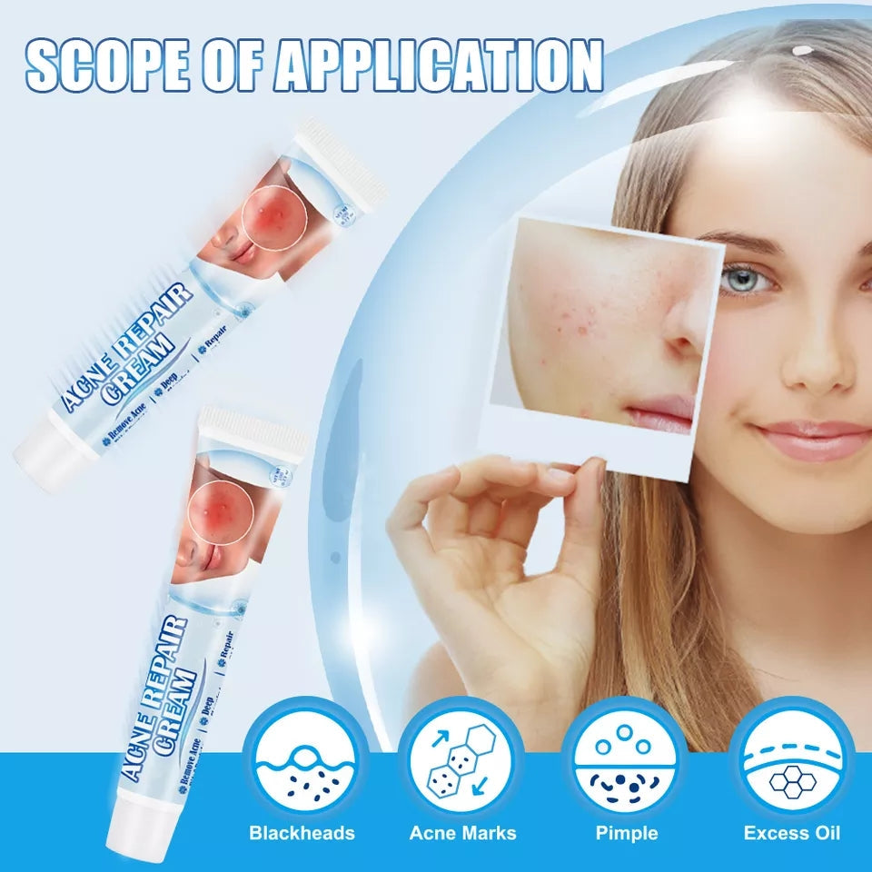 Acne Repair Cream | Herbal Ointment for Pimples, Acne Marks, Postules, and Blackheads - Image 3