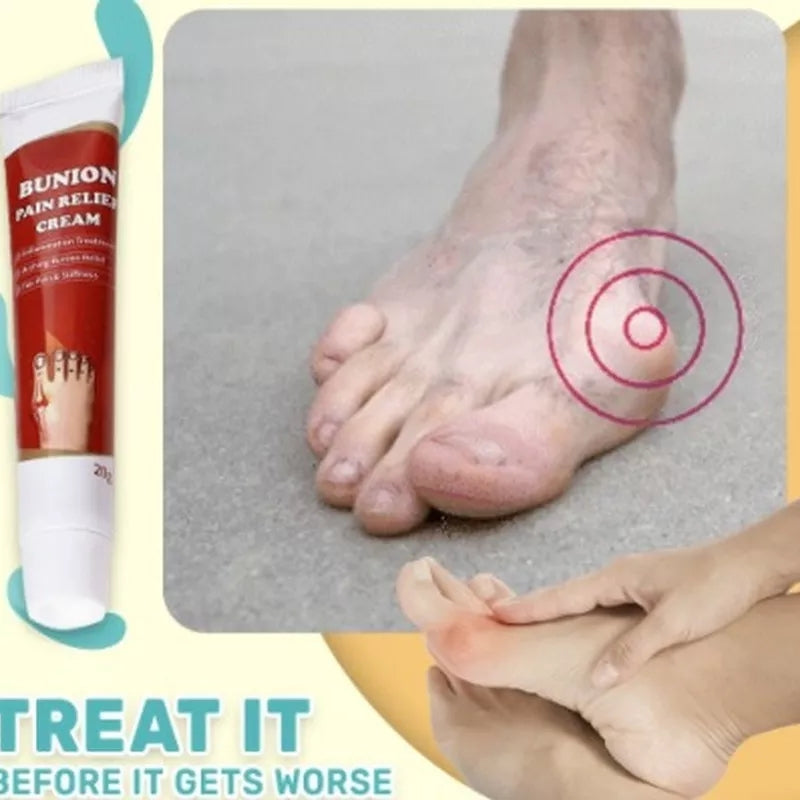 Bunion Pain Relief Cream | Herbal Cream for Bunions and Stiff Toes - Image 4