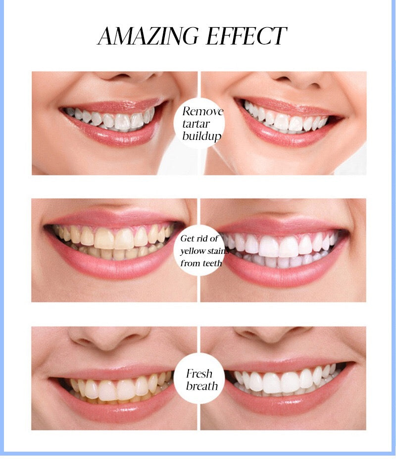 EFERO Teeth Whitening Pen | Tooth Whitening Gel - Image 10