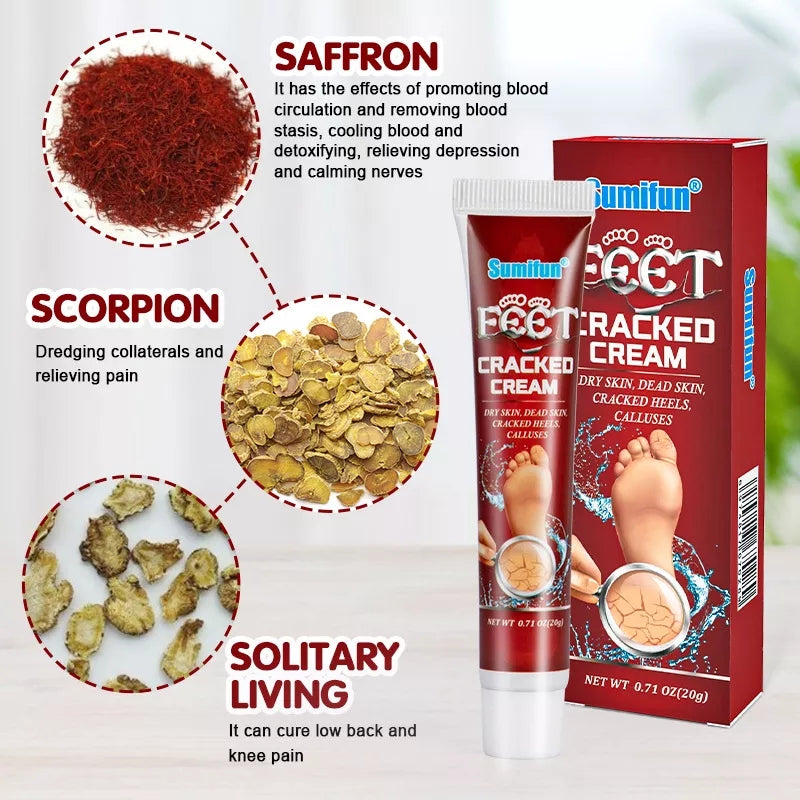 Cracked Hands and Feet Cream | Skin Ointment for Cracked Heels, Dry Skin and Dead Skin - Image 14