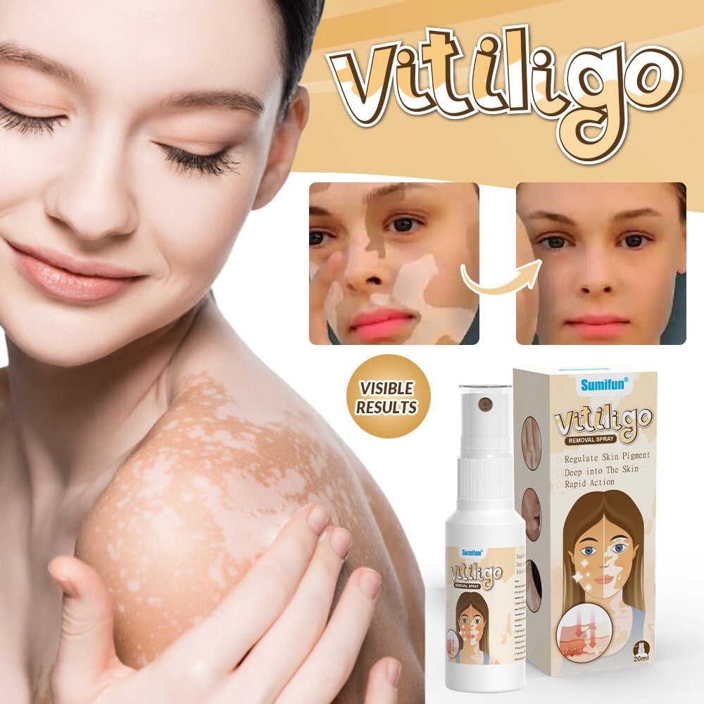 Vitiligo Removal Spray | Topical Spray for Skin Pigmentation and White Patches - Image 5