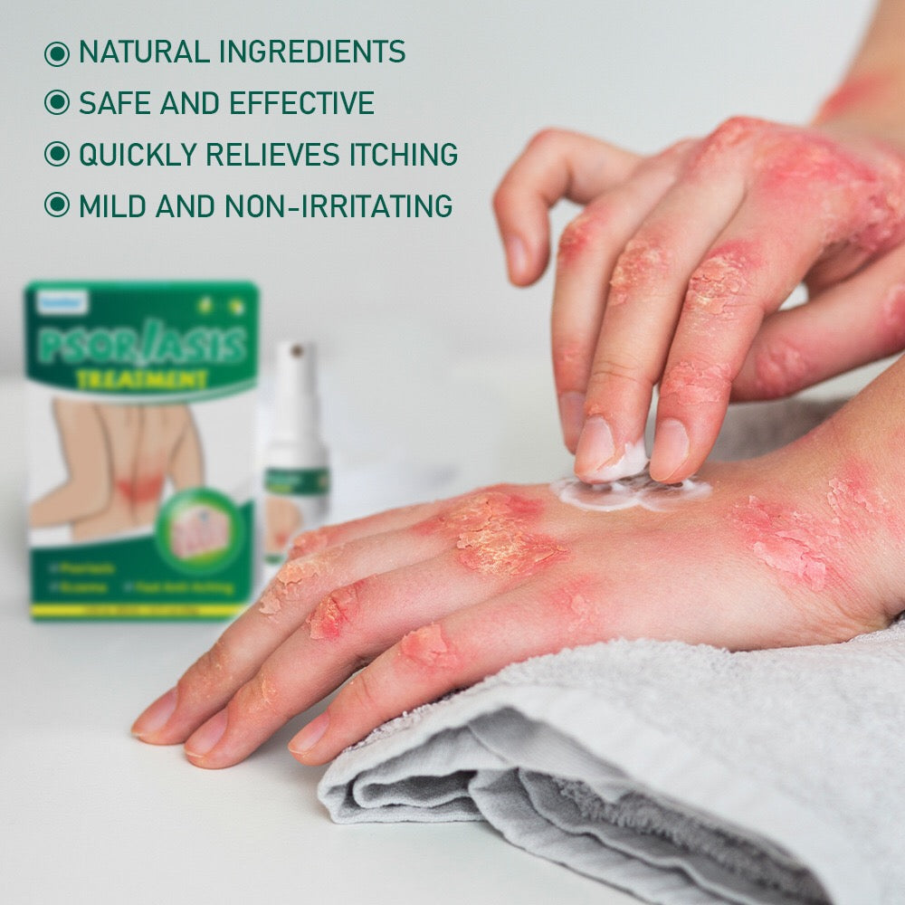 Psoriasis Treatment Pack (Cream + Spray) | Topical Remedy for Psoriasis, Eczema, and Itching - Image 4