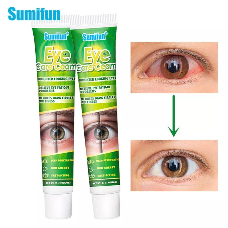 Eye Care Cream | Herbal Cream for Bright Eyes, Eye Fatigue, Dark Circles, and Puffiness - Image 2