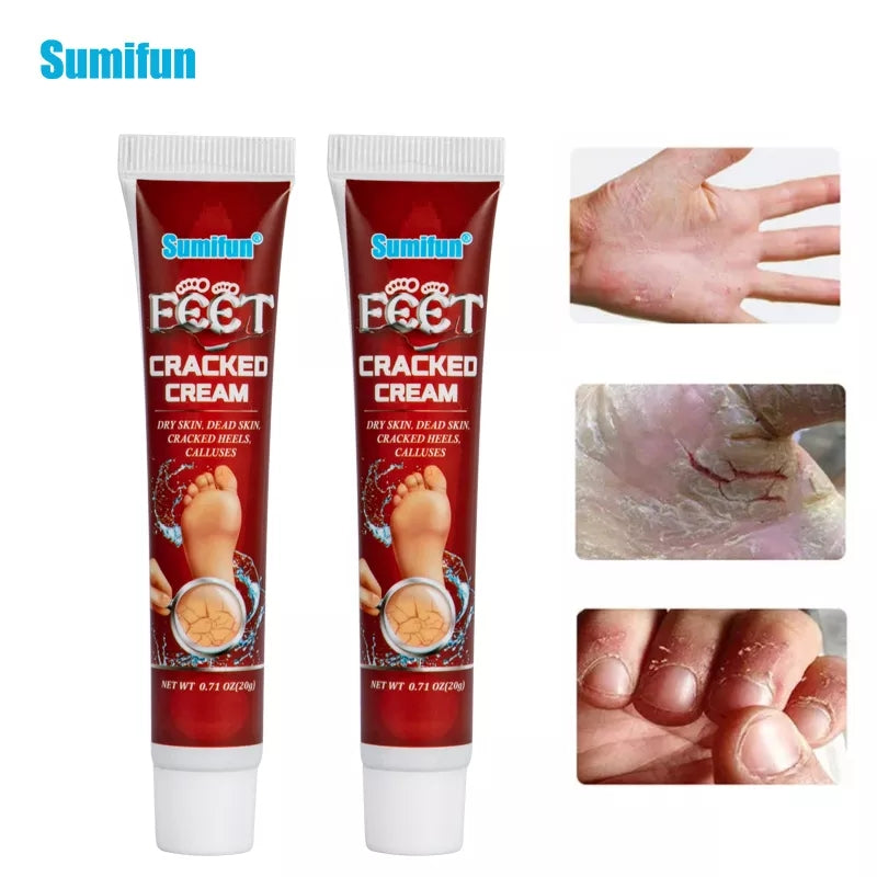 Cracked Hands and Feet Cream | Skin Ointment for Cracked Heels, Dry Skin and Dead Skin - Image 2
