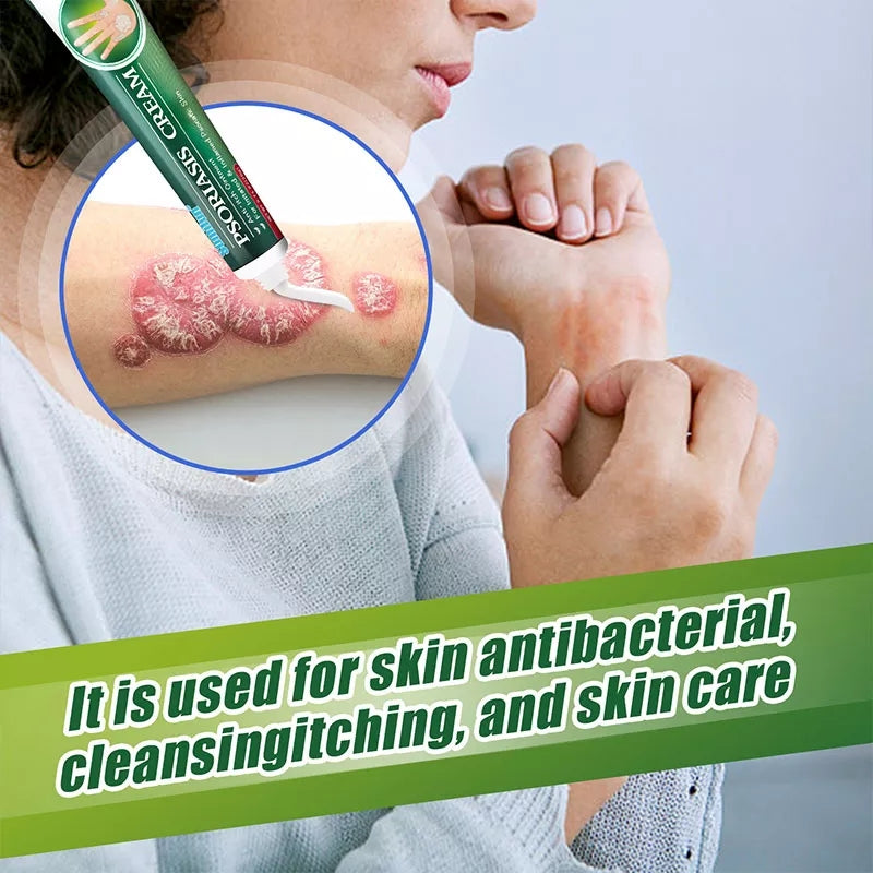 Psoriasis Cream | Herbal Cream for Psoriasis, Dermatitis, Eczema, and Itching - Image 3