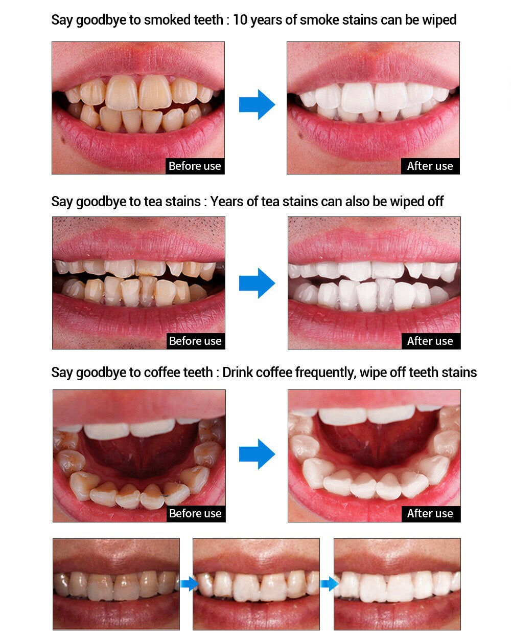 LANBENA Teeth Whitening Essence - Image 4