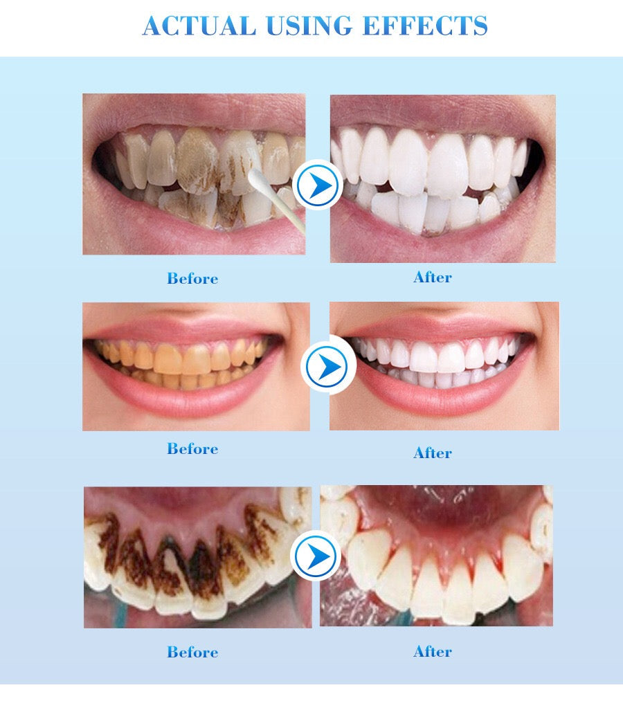EFERO Teeth Whitening Essence - Image 5