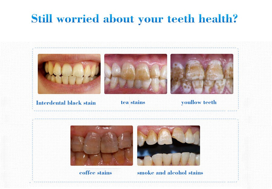 EFERO Teeth Whitening Essence - Image 3