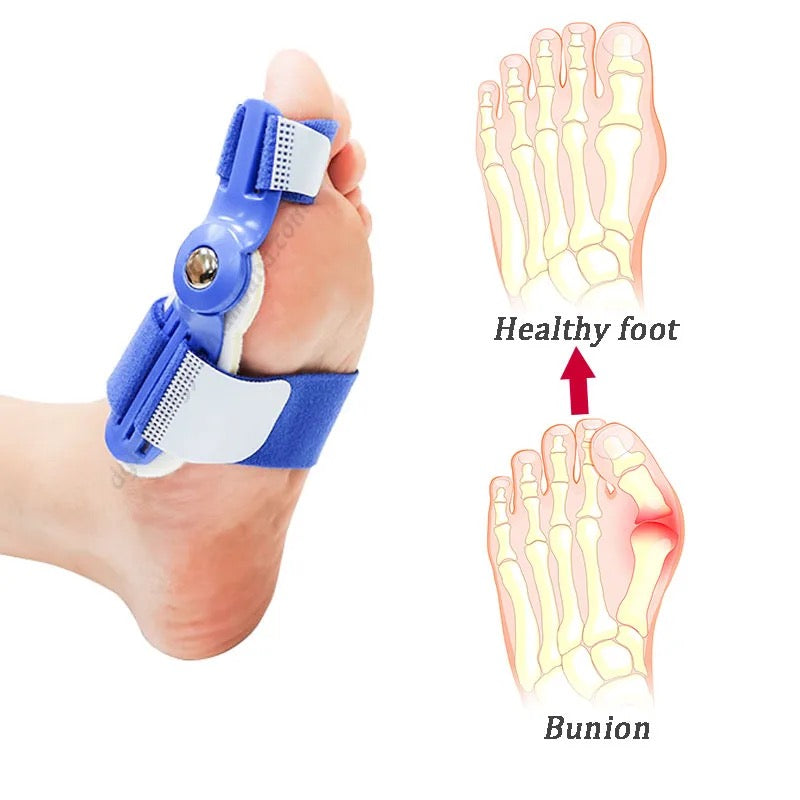 Bunion Corrector | Hallus Valgus Corrector | Orthopedic Bunion Splint - Image 17