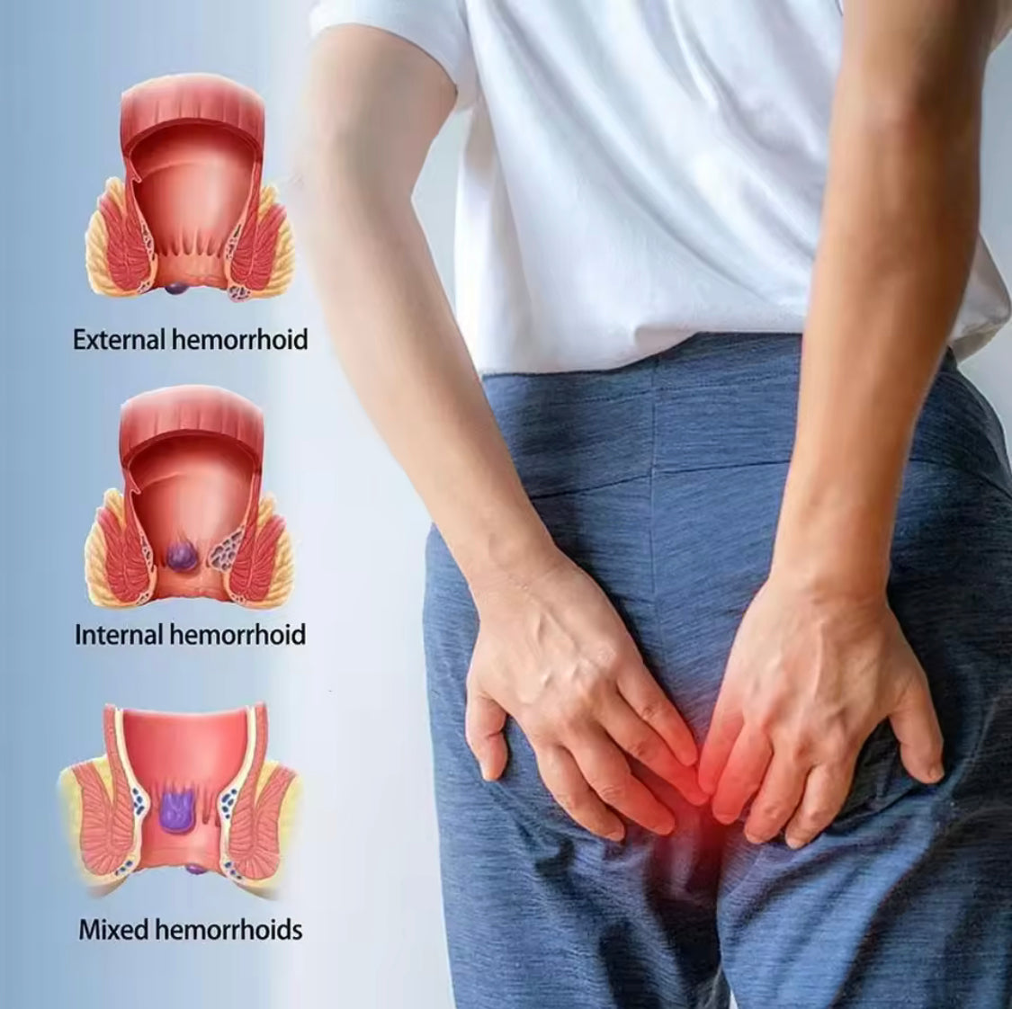 APGMA Hemorrhoid Lick Cold Compress Gel | Topical Cream for Internal and External Pile - Image 2