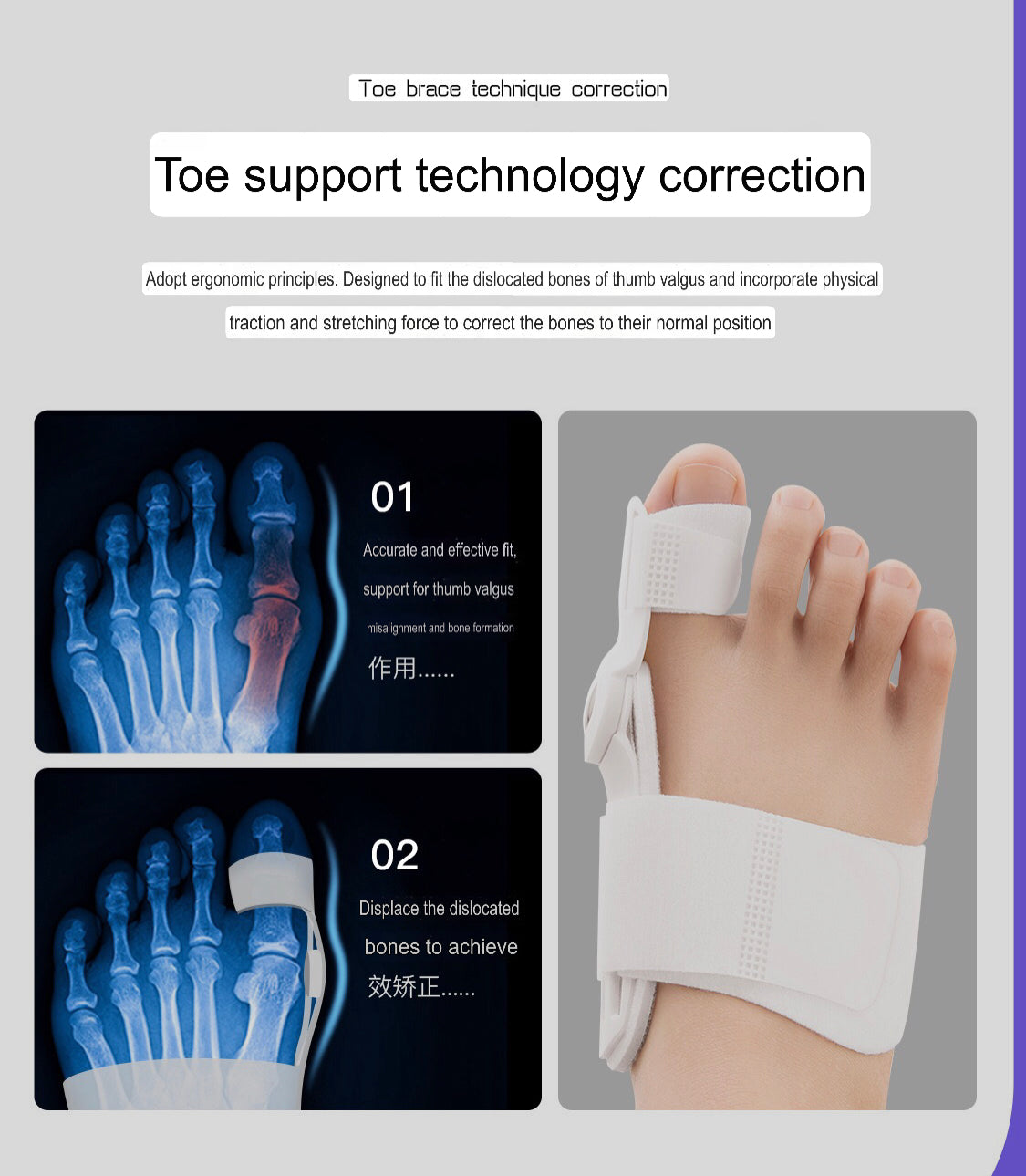 Bunion Corrector | Hallus Valgus Corrector | Orthopedic Bunion Splint - Image 4