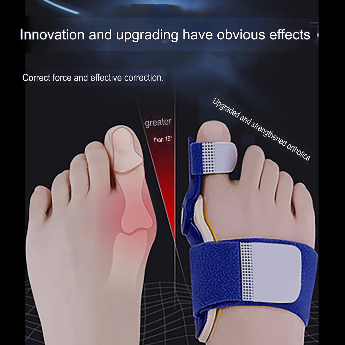 Bunion Corrector | Hallus Valgus Corrector | Orthopedic Bunion Splint - Image 2