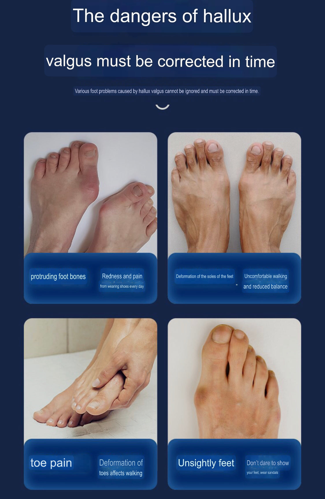 Bunion Corrector | Hallus Valgus Corrector | Orthopedic Bunion Splint - Image 3