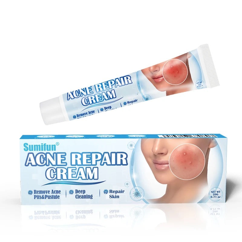 Acne Repair Cream | Herbal Ointment for Pimples, Acne Marks, Postules, and Blackheads