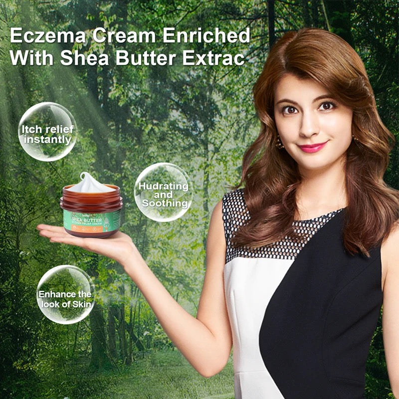 Pure African Shea Butter Cream (113g) | Topical Cream for Eczema, Psoriasis, Itching, and Dry Skin - Image 6