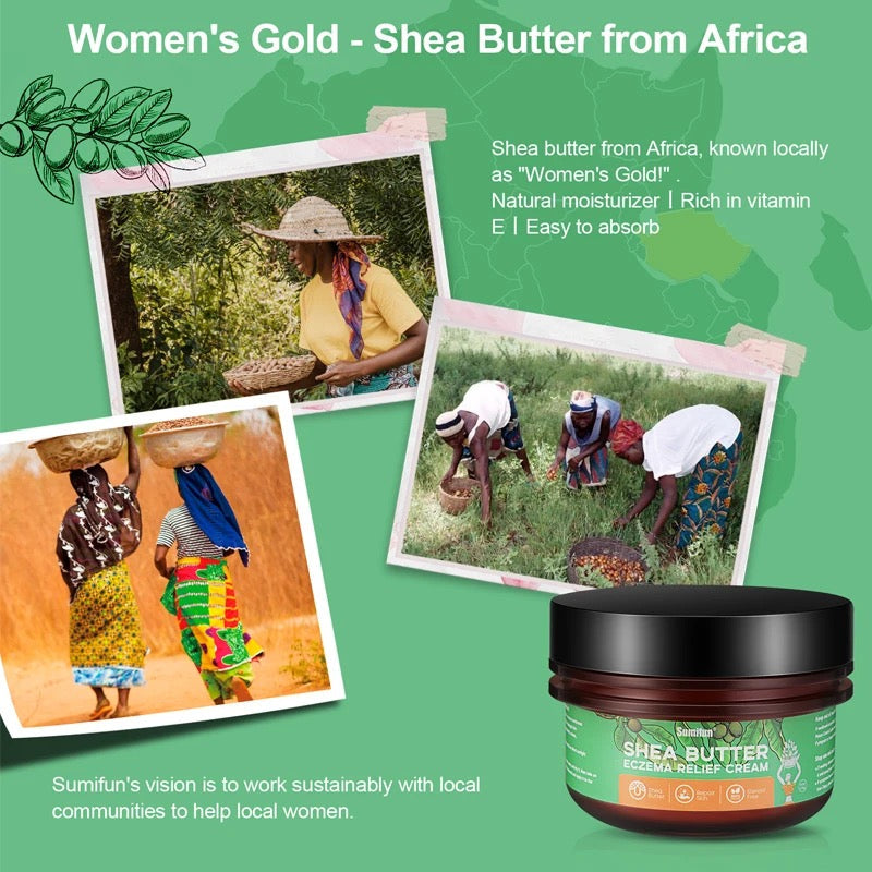 Pure African Shea Butter Cream (113g) | Topical Cream for Eczema, Psoriasis, Itching, and Dry Skin - Image 3