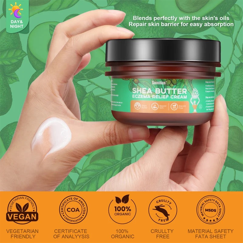 Pure African Shea Butter Cream (113g) | Topical Cream for Eczema, Psoriasis, Itching, and Dry Skin - Image 5