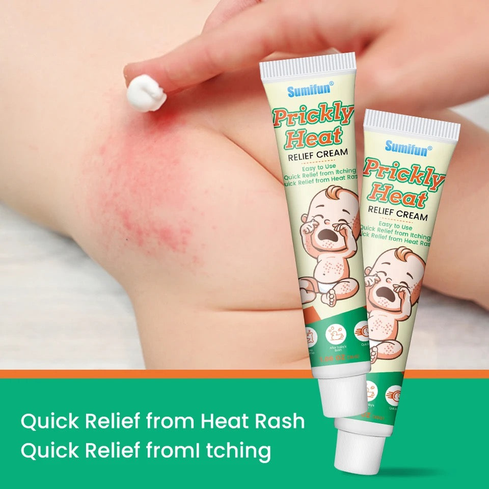 Prickly Heat Relief Cream for Babies | Topical Cream for Dermatitis, Eczema, Mosquito Bites, Itching, and Rashes on Babies - Image 2